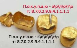 Покупаю золото, коронки, лом, 8.7.о.2.9.9.4.1.1.1.1